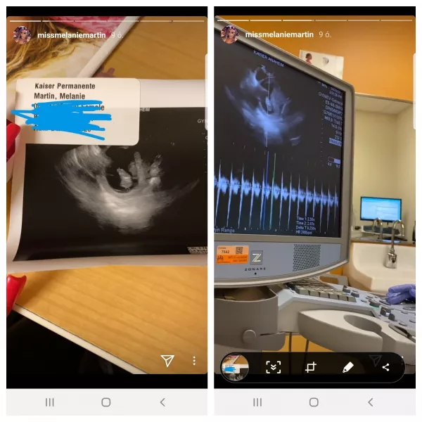 Melanie néhány órája több ultrahangos képet és videót is megosztott, egyszersmint bizonyítva, valóban babát vár. Aztán kitett még valamit, egyértelműen Aaronnak címezve. 