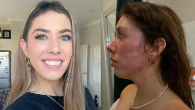 Letaglózta a fiatal lányt a rákdiagnózis: egy év múlva hihetetlen dolgot fedeztek fel az orvosok - Videó